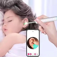 Outil Nettoyage Oreilles Caméra HD | Éliminateur de Cérumen Sécurisé
